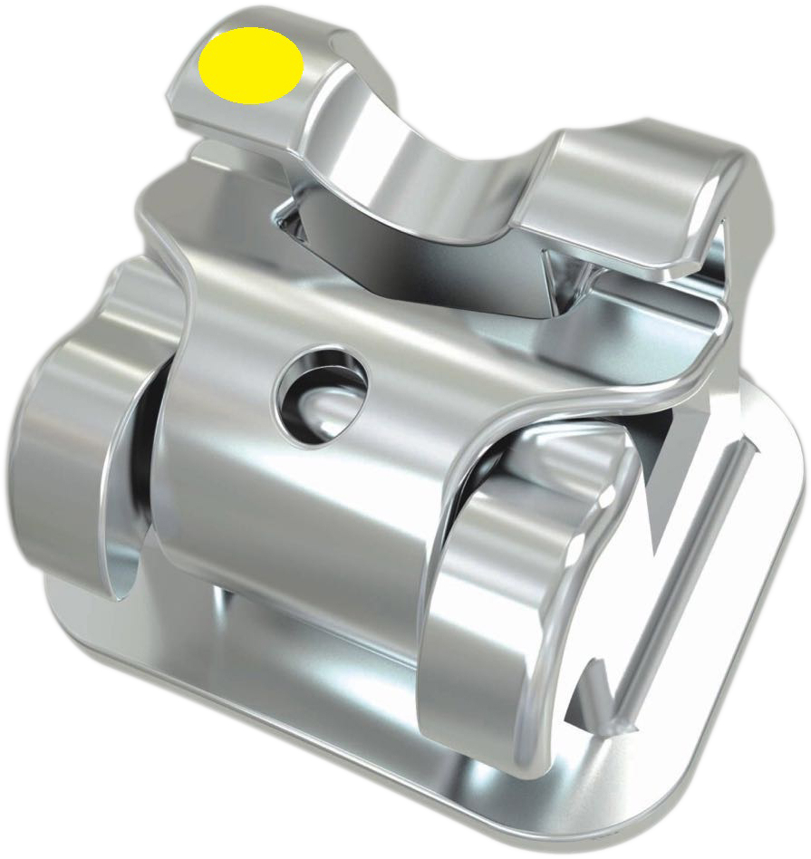Oppa aktives selbstligierendes Bracket .022 MBT 5/PK