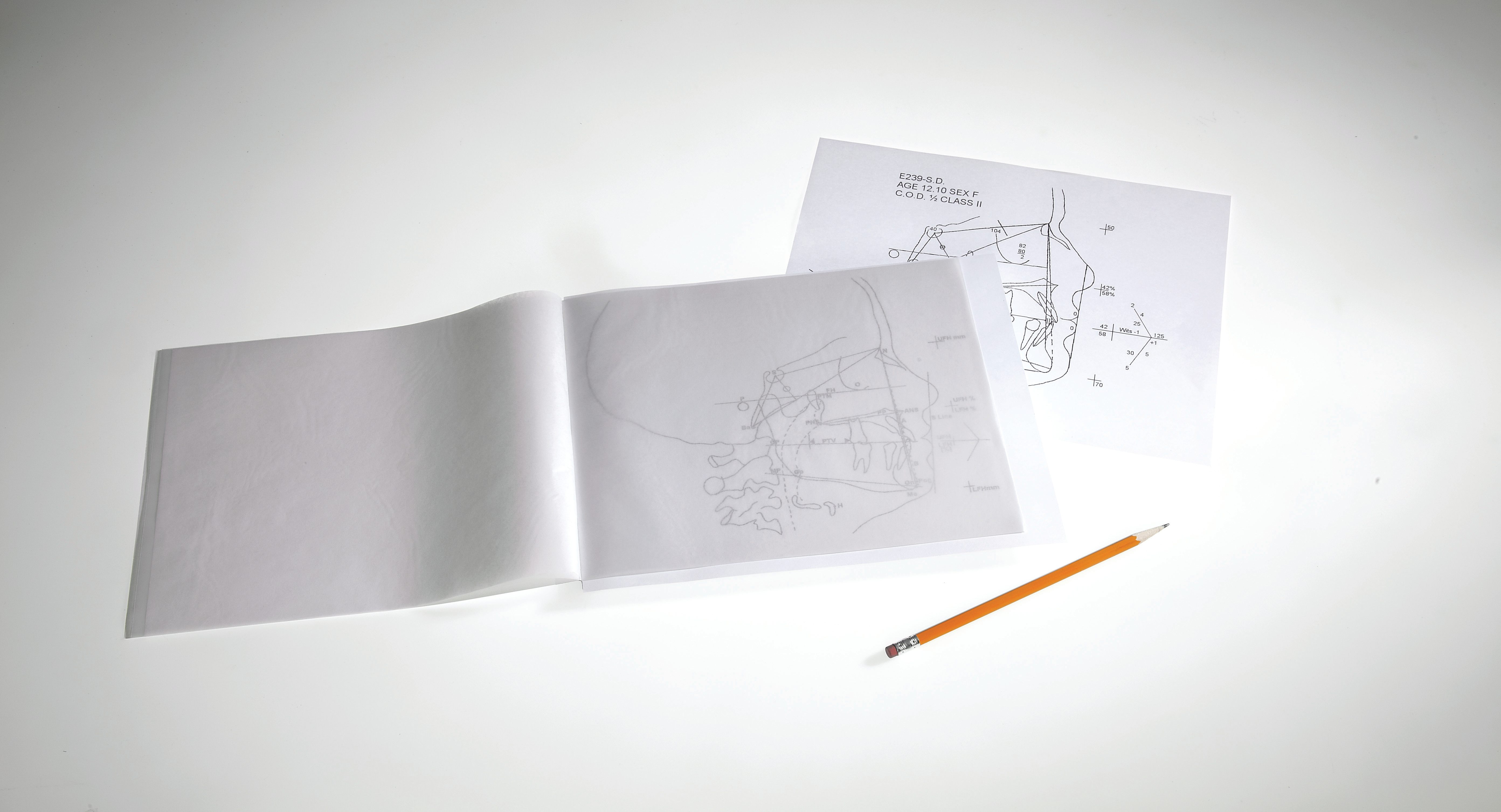 Durchzeichenfolie 100 Blatt 8" x 10"