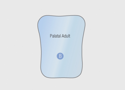Riofoto Mirror Palatal / Adult